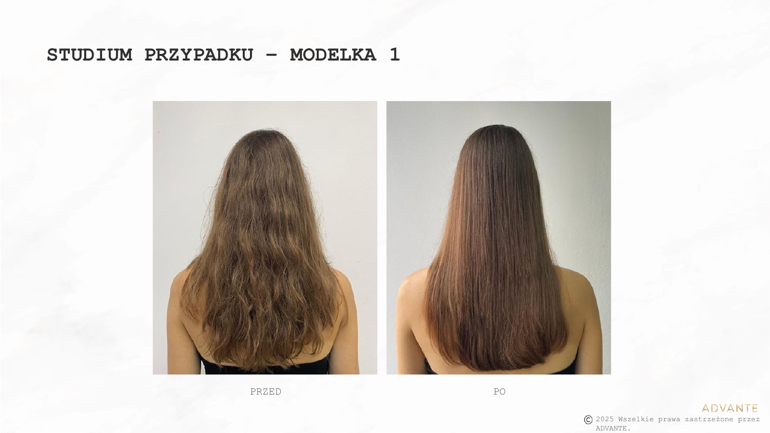 Przed i po – Modelka 1